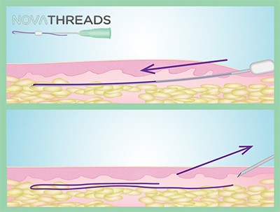 pdoThreading